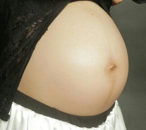 准妈妈肚子上为啥会有妊娠线,妊娠线会一直存在吗