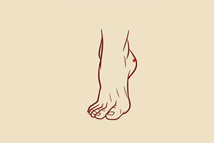 痣相分析女人脚后跟有痣代表什么意思,女的脚后跟有痣