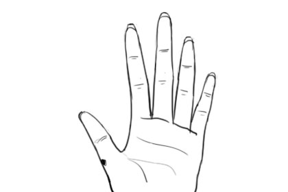 手掌长痣代表什么,手掌长痣代表什么 男