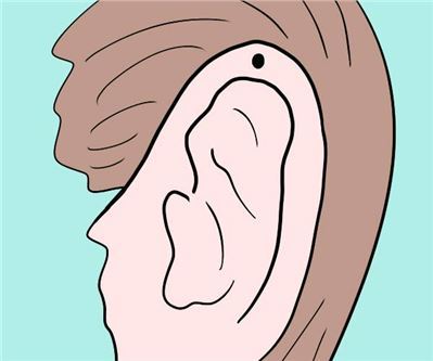 耳朵有痣代表什么图解
