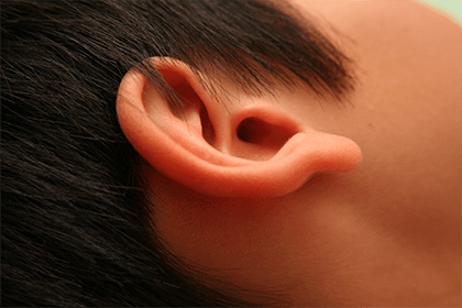 耳朵痣相图解女人 耳朵上的痣有什么含义