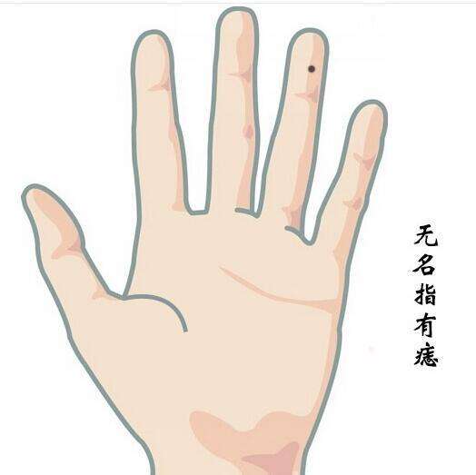 手指上有痣图解:手指上有痣代表什么意思,手指上有痣是什么意思