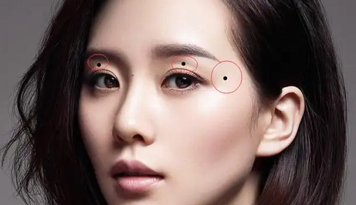 女人眼皮上长有痣代表什么