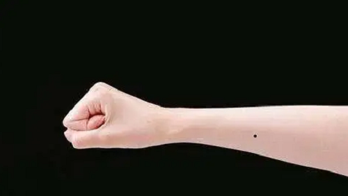 右手手臂有痣代表什么,右手手臂有痣代表什么意思