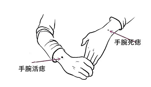 左手腕正中间有痣代表什么,左手腕正中间有痣代表什么女人